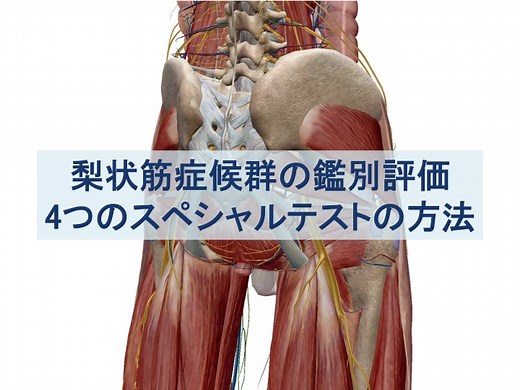 梨状筋症候群を鑑別するために行うべき4つのスペシャルテスト
