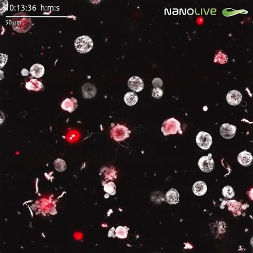 Fluorescently labelled cancer cells in co culture with preadipocytes
