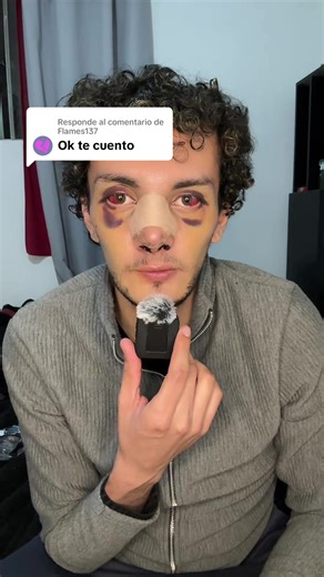 Respuesta a @Flames137 #rinoplastia