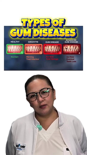Understanding Types of Gum Diseases