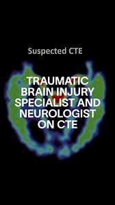 2.2K views | Traumatic Brain Injury Specialist and Sports Neurologist Dr. Daniel Rafie takes us through CTE. Chronic Traumatic Encephalopathy (CTE) is a progressive disease that forms in the brain from repetitive head impacts and trauma. CTE became a widely used term when referring to NFL players' questionable behavior, as behavioral issues are a primary symptom of the disease. | VICE Sports | Facebook