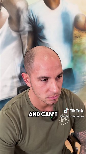 Achieving a Youthful Look with Natural Hairline | Hair Tattoo Process