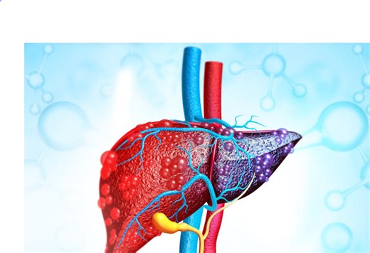 Autoimmune hepatitis: the hidden liver disease many don't know about