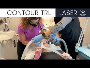 Contour TRL Skin Resurfacing