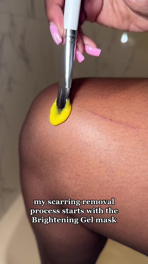 How to Get Rid of Deep Cuts Scarring on Your Skin