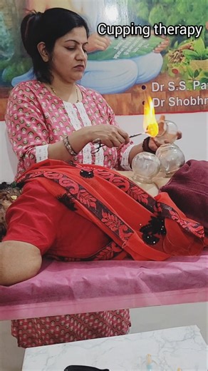 cup therapy for backpain #cuppingtherapy #ytshorts