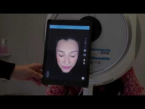 Skin Scanner Consultation | Eden Skin Clinic Treatments