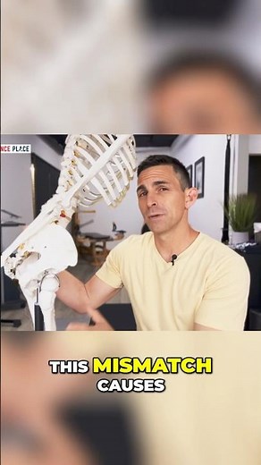 What Causes Hip Impingement?