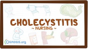 Cholecystitis: Nursing: Video & Causes | Osmosis
