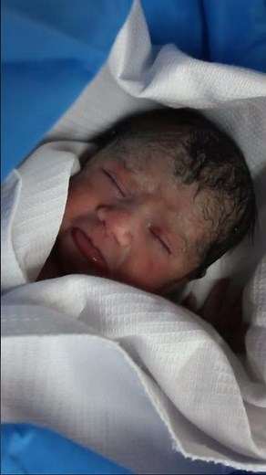 My newborn baby crying so beautifully immediately after birth 😍