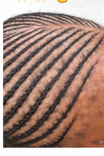 Snoopy-Inspired Hairstyle Tutorial