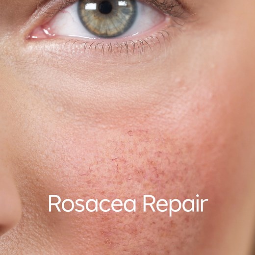 “Rosemira products have completely cleared my Rosacea over the past 2 months. I'm blown away.” - Sarah L. (49) You’ll get 25% off, free shipping, and a 100% satisfaction guarantee. | Rosemira Organics Skin Care