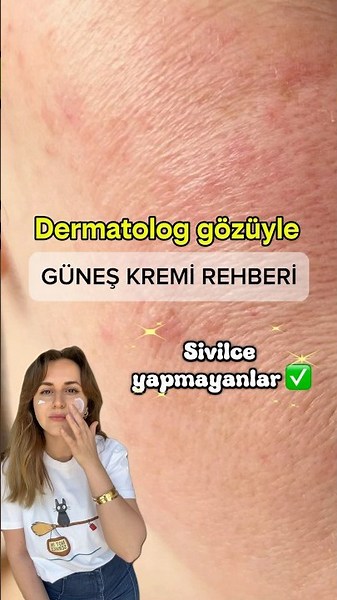 A dermatologist's guide to sunscreens - those that don't cause acne 📌 #notan advertisement