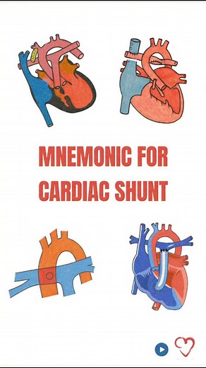 12K views · 802 reactions | Cardiac shunts can be surgically created...