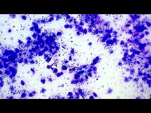 Vaginal hyperplasia cytology