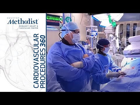 Thrombolysis of the Splenic and Superior Mesenteric Vein 360 Video. Alan Lumsden, MD; Trisha Roy, MD