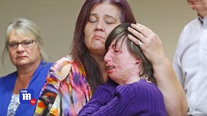 Bitter ex-boyfriend lights his ex-girlfriend on fire