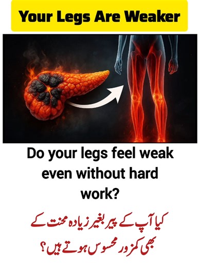 Fix Weak Legs Caused By Metabolic Issues