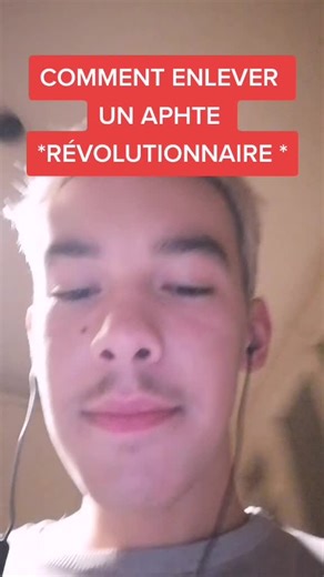 Comment Enlever un Aphte Facilement avec du Citron - Astuce Maison
