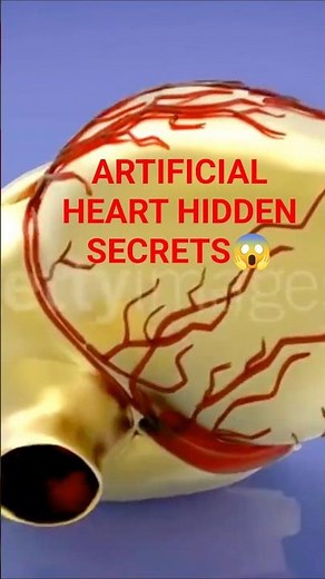 How Artificial heart implanted Quick and easy to learn!