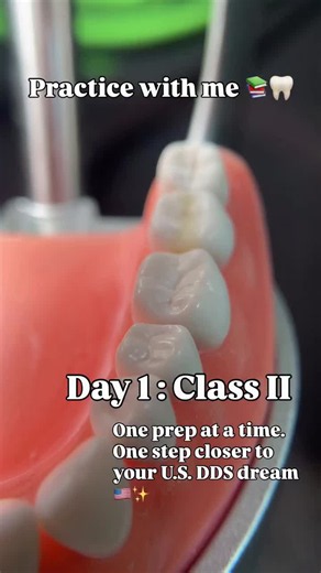 Class II Cavity Preparation Technique for Natural Tooth