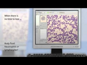 Sysmex - Optimisation of the quality of the results and the turn-around times in the laboratory
