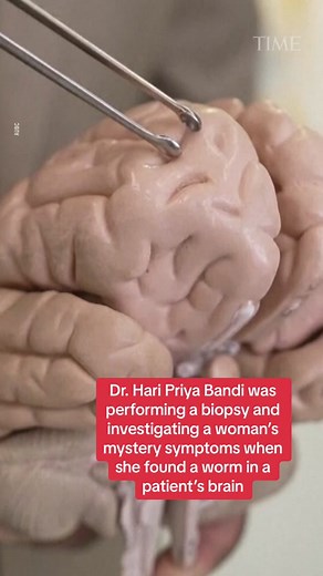 Intriguing Medical Mystery: Worm Discovered Inside Patient's Brain