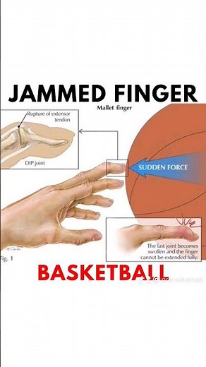 How to STOP Jammimg Fingers in Basketball #basketball #shorts