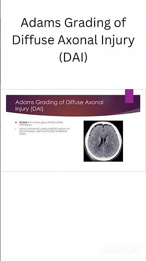 Adams Grading of Diffuse Axonal Injury (DAI)