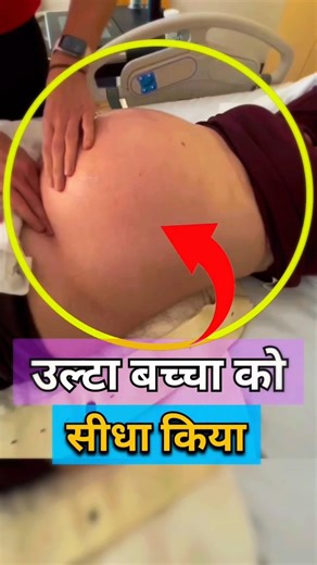 Operation नहीं… ऐसे सीधा होता है बच्चा! 🔄 | #youtubeshorts