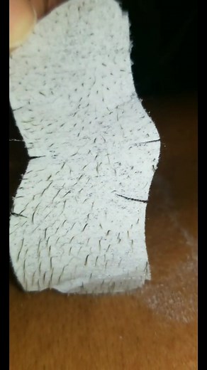 biore strips even work on your back! we're getting the whole family now😏 @bioreus