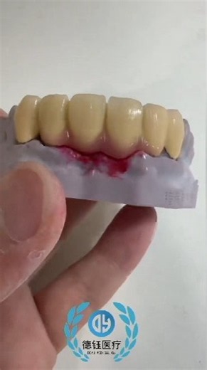 Full Zirconia Multi-Unit Bridge | Stable Outsourcing for Dental Labs & Clinics