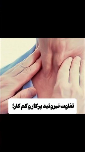 تفاوت تیروئید پرکار و کم کار #سلامتی #پزشکی #دکتر #درمان #بدن_انسان #نکات_پزشکی