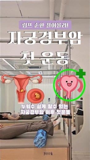 자궁경부암 수술 이후 첫 운동 뭐가 좋을까?
