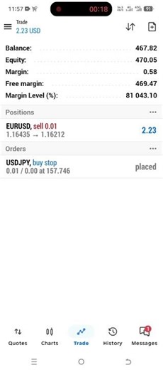 Growing a Small Trading Account Takes Time 💰 | The Truth About Forex Success