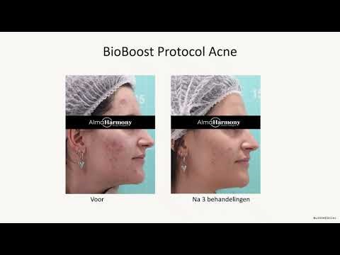 Webinar Alma Harmony Bio-Boost™