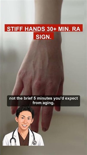 Morning Hand Stiffness Over 30 Min: An Early RA Sign