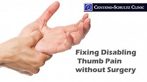 Why We Give Thumb Surgery a Big Thumbs-Down