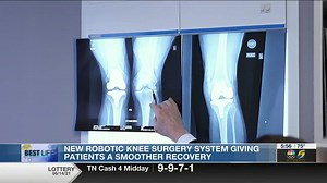 Best Life: New robotic knee surgery system giving patients a smoother recovery