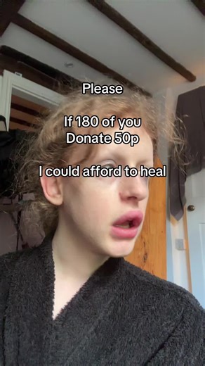 Help Fund My Alpha Stim Device for Healing