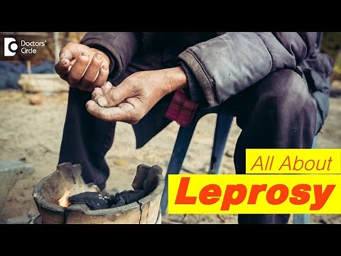 5 Symptoms of Leprosy | Types of Leprosy |World Leprosy Day 2021-Dr.Rashmi Ravindra| Doctors' Circle