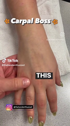 Ever seen a carpal boss before? #anatomy #handanatomy #medical #medschool #handtherapy #handinjury #extensortendons #handpain