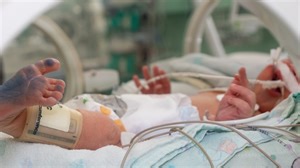 Why is the premature birth rate in the United States on the rise?