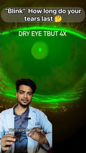 TBUT test for dry eye explained| Dry Eye Check in Seconds!” #dryeye #eyes #doctor