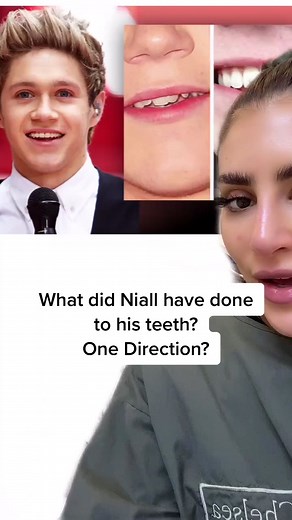 Niall Horan Teeth Transformation: Bonding and Veneers Explained