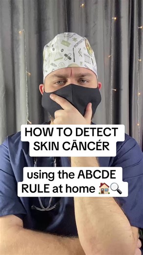 Spotting Skin Cancer: The ABCDE Rule at Home