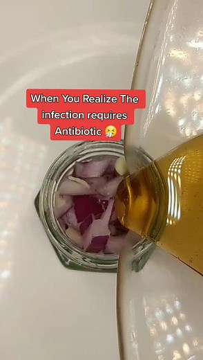 Do you know this Natural Antibiotic Recipe?#antibiotics#antibiotic#herbs#garlic#eliyahmashiach#learnfromeliyahmashiach