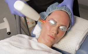 Fractionated Laser Resurfacing | Treatment | Aspire Training Clinic