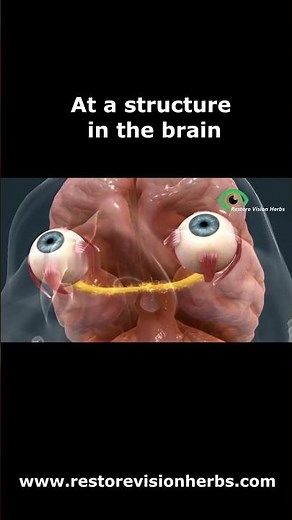 Overview of Optic Nerve Disorders - The Retina and Optic Nerve