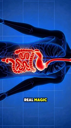 Appendectomy Surgery Explained Simply (3D Animation) #medicaleducation #healthcare #fyp